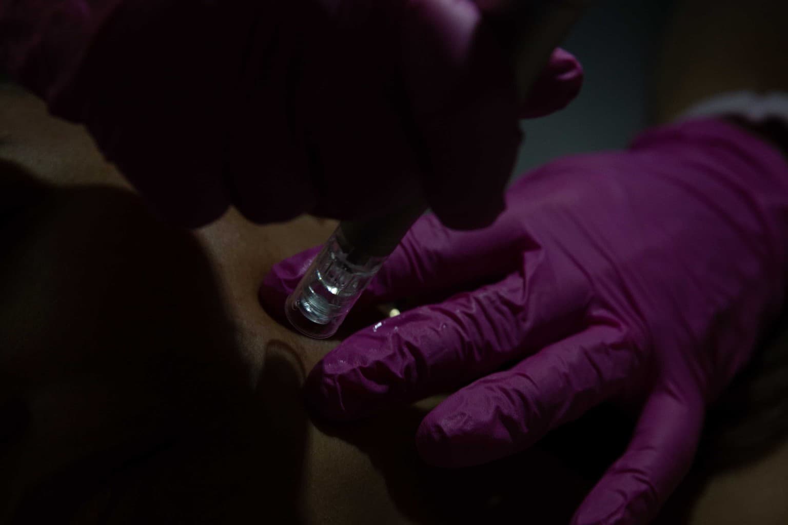 Serum, consent materials, and treatment tools prepared for Phase 1 enrollment