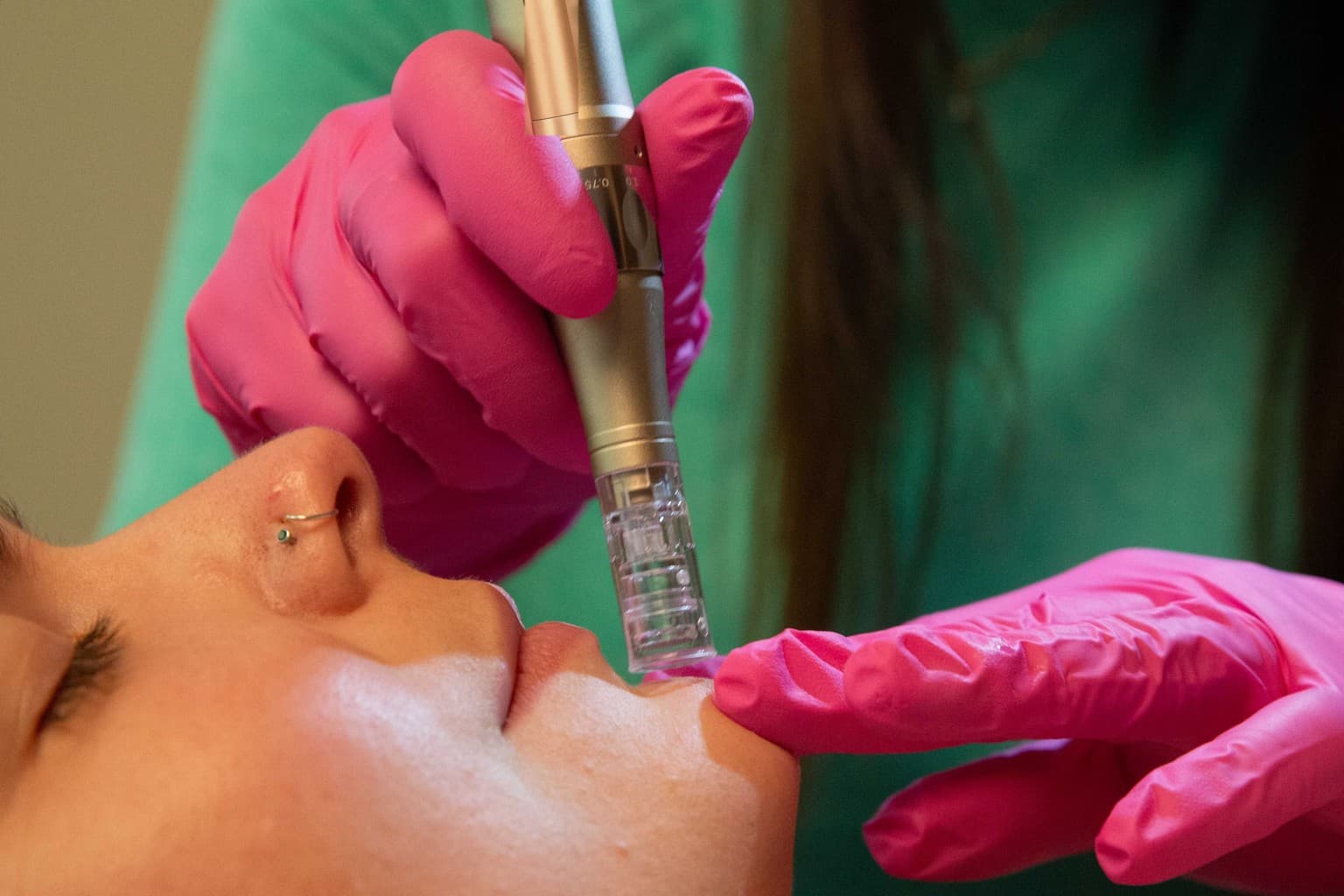 Clinical still suggesting skin structure beneath the surface — regenerative microneedling education