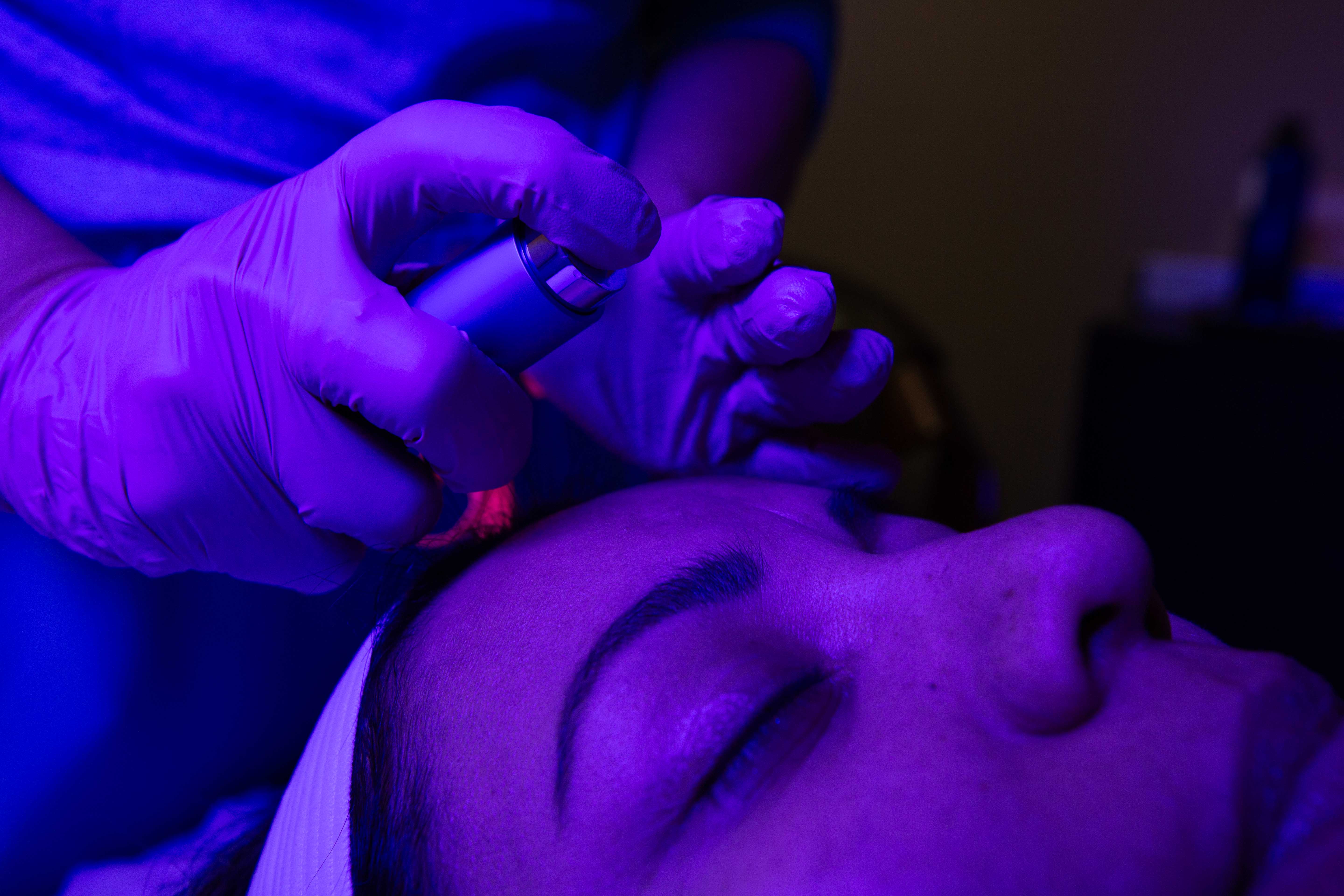 LED-supported Healthy Aging microneedling for Short Pump patients